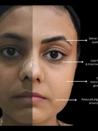 Medical-Grade Facials & Peels