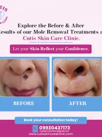 Medical Dermatology