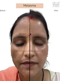 Medical-Grade Facials