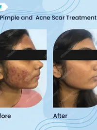 Aesthetic Dermatology