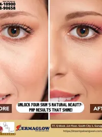 Pigmentation & Skin Tone Correction