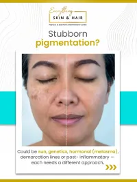 Skin Brightening & Pigmentation Correction