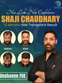 Hair Transplant & Restoration