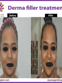 Facial Anti-Aging & Rejuvenation