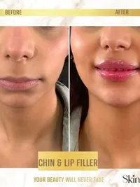 Injectables & Anti-Ageing Treatments