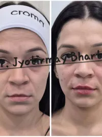 Anti-Aging & Injectables