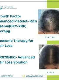 Hair Restoration & Scalp Health