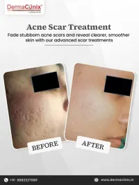 Aesthetic Dermatology