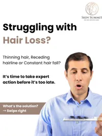 Hair Restoration Treatments