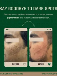 Pigmentation & Skin Brightening