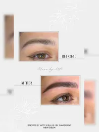 Brow Enhancement