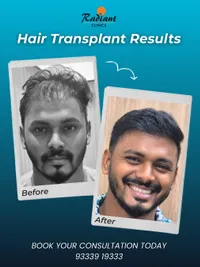 Hair Transplant