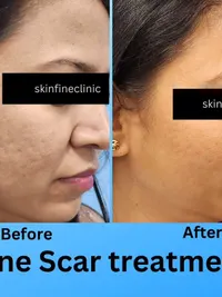 Aesthetic Dermatology