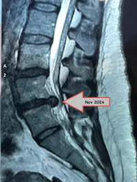 Orthopaedic Physiotherapy & Pain Management