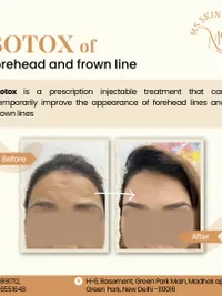 Anti-Aging & Facial Contouring