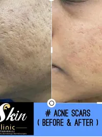 Cosmetic Dermatology
