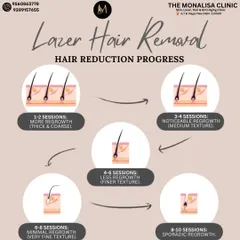 This infographic illustrates the typical hair reduction progress you can expect. While initial sessions show some regrowth, the hair becomes noticeably finer and sparser after 4 to 6 sessions, leading to long-term, smooth results.
