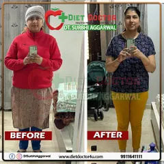 A duplicate view of Ms. Yashika's incredible 10 kg weight loss in 3 months postpartum. Her success highlights the effectiveness of a guided nutrition plan for new mothers.