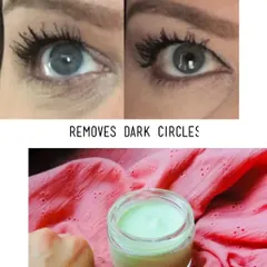 Dark circles can be tough, but my Magical Under Eye Cream is here to help. This before and after shows how it works to reduce puffiness and brighten the under-eye area.