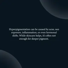 Hyperpigmentation has multiple triggers, including sun exposure, inflammation from acne, or hormonal shifts. While topical skincare can help, deeper or stubborn pigment often requires professional intervention.