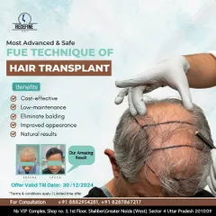 An informational graphic explaining the benefits of our advanced FUE hair transplant technique. We highlight that it is a cost-effective, low-maintenance solution that eliminates balding with natural-looking results.