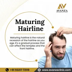A maturing hairline is a natural process of recession that can affect the temples and frontal area. While common, we have effective medical and surgical treatments to manage it and restore a more youthful hairline.