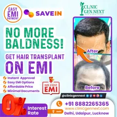 No more baldness. Get your hair transplant on a no-cost EMI plan with instant approval and minimal documents. Don't let budget hold you back from regaining your confidence.