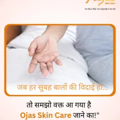 "Jab har subah baalon ki vidaai ho... toh samjho waqt aa gaya hai Ojas Skin Care jaane ka!" Waking up to hair on your pillow is a clear sign that it's time to seek professional help.
