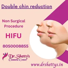 A double chin can be addressed without surgery using High-Intensity Focused Ultrasound, or HIFU. This non-surgical procedure tightens the skin and reduces fat, creating a more defined jawline and a balanced facial profile with no downtime.