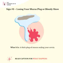Sign #3: Losing your mucus plug or having a "bloody show." This is a sign your cervix is starting to soften and change.