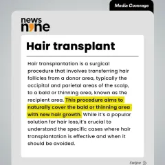 This article explains the basics of a hair transplant, a surgical procedure that transfers hair follicles to a bald or thinning area. It is crucial to understand when this procedure is effective and when it should be avoided.