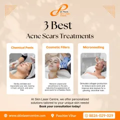 This graphic shows the three best treatments I offer for acne scars: chemical peels for exfoliation, cosmetic fillers for volume, and microneedling for collagen production.