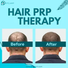 This before and after image shows the real results of our Hair PRP Therapy. We use the body's own healing properties to significantly reduce hair loss and promote new, healthy growth.