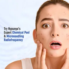 This monsoon, wash away your acne stress. At my clinic, I offer advanced solutions like expert chemical peels and microneedling radiofrequency to tackle acne effectively and give you clear, smooth skin.