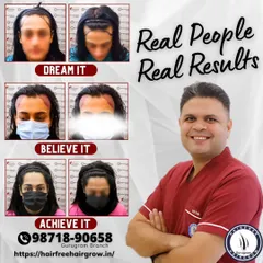 Hair loss in women requires a very specific and delicate approach. Here, I restored the frontal hairline and temporal angles for this patient using 2010 grafts. The 6-month result shows how we can achieve a natural, feminine hairline that beautifully frames the face.