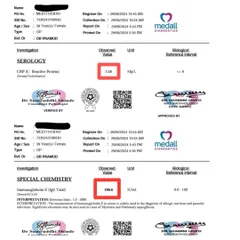 This report documents the progress of a 39-year-old female suffering from chronic allergic rashes and high inflammation markers (CRP and IgE). In just 20 days, our treatment protocol, including rational Panchakarma, brought her inflammation down and provided 70% relief from symptoms that years of conventional medicine couldn't solve.