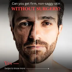 This visual demonstrates the transformative effect of our non-surgical anti-aging treatments. We can achieve firm, lifted skin by combining advanced technologies like RF Microneedling and HIFU with injectables to boost natural collagen and restore youthful contours.