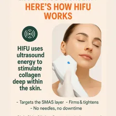 How does HIFU work? This graphic explains the science. Ultrasound energy is used to stimulate collagen deep within the skin's foundational SMAS layer, resulting in firming and tightening from the inside out, all without needles.
