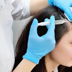 Here you can see the PRP treatment being administered. A concentrated solution of platelets from your blood is injected directly into the scalp to deliver growth factors where they are needed most.