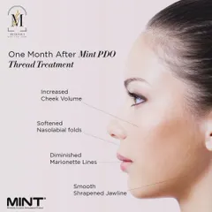 This graphic shows the results you can expect one month after a MINT PDO thread treatment. It highlights benefits like increased cheek volume, softened nasolabial folds, and a smoother, sharpened jawline.