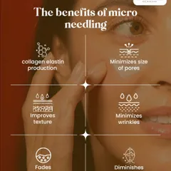 Microneedling, also known as collagen induction therapy, is a sophisticated procedure for skin rejuvenation. It creates micro-injuries to stimulate the body's natural wound healing process, resulting in increased collagen and elastin production, which improves texture, pores, wrinkles, and scarring.