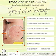 An overview of the different types of acne treatments we offer, from topical medications and chemical peels to advanced options like microneedling and laser therapy.