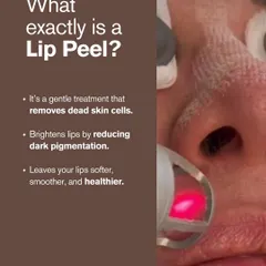 What exactly is a lip peel? It's a gentle treatment that removes dead skin cells, reduces dark pigmentation, and leaves your lips feeling softer, smoother, and healthier.