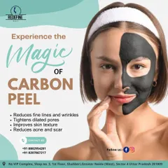 The Carbon Peel, or "Hollywood Peel," is excellent for reducing fine lines, tightening pores, and improving skin texture. It's a great option for anyone looking for a quick refresh with no downtime.