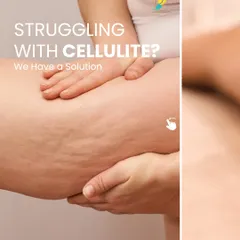 If you are struggling with cellulite, we have a solution. This image shows a common area affected by cellulite, which is a concern for many of my clients. Our treatments are designed to address this directly.