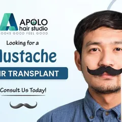 If you are considering a moustache hair transplant, we are here to help. We use advanced techniques like FUE to ensure your new moustache looks and feels like your own hair, giving you a permanent solution for a stronger look.