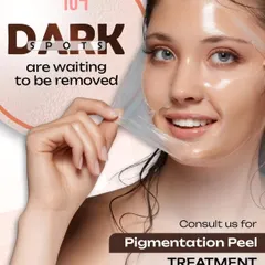 Those dark spots left behind by acne are waiting to be removed. Our specialized Pigmentation Peel Treatment is designed to lift these post-inflammatory marks, revealing clearer and more even skin.
