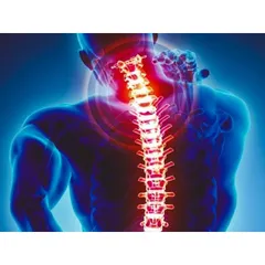 Spondylosis, or persistent neck and spine pain, is a Vata disorder affecting the bone tissue ('asthi dhatu'). My treatment involves therapies like Greeva Basti (warm oil on the neck) and medicated oils to reduce stiffness. Herbal supplements help restore flexibility and improve spinal health naturally.