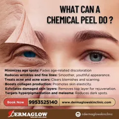 This graphic explains what a chemical peel can achieve. I use them to address a variety of concerns, from minimizing age spots and fine lines to treating acne scars and boosting collagen. It's a powerful tool for safe and effective skin resurfacing.