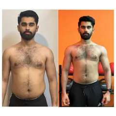 This front-view comparison highlights a successful body recomposition. We focused on reducing body fat while building lean muscle in the shoulders and chest for a more athletic physique.